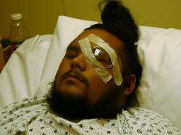 Jasmir Singh, After Having Undergone Eye Surgery